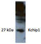 Potassium Voltage-Gated Channel Interacting Protein 1 antibody, AP26424AF-N, Origene, Western Blot image 