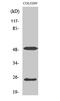 Lecithin Retinol Acyltransferase antibody, STJ93952, St John