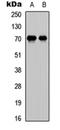 Leptin Receptor antibody, orb256343, Biorbyt, Western Blot image 