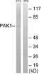 Alpha-PAK antibody, LS-C118317, Lifespan Biosciences, Western Blot image 