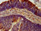 BNC1 antibody, LS-C669708, Lifespan Biosciences, Immunohistochemistry paraffin image 