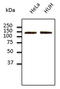 Cadherin 2 antibody, LS-C204223, Lifespan Biosciences, Western Blot image 