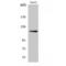 SPT16 Homolog, Facilitates Chromatin Remodeling Subunit antibody, LS-C386156, Lifespan Biosciences, Western Blot image 