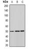 Aldehyde Dehydrogenase 9 Family Member A1 antibody, abx142022, Abbexa, Western Blot image 