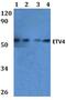 ETS Variant 4 antibody, PA5-75845, Invitrogen Antibodies, Western Blot image 