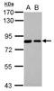 Sorting Nexin 9 antibody, NBP2-20348, Novus Biologicals, Western Blot image 