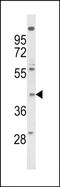 Formyl Peptide Receptor 3 antibody, PA5-72577, Invitrogen Antibodies, Western Blot image 