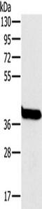 Ornithine Carbamoyltransferase antibody, TA350254, Origene, Western Blot image 