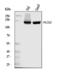 Phospholipase C Gamma 2 antibody, A03572-1, Boster Biological Technology, Western Blot image 
