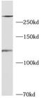 Leucine Rich Repeat Kinase 2 antibody, FNab10520, FineTest, Western Blot image 