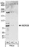 WD Repeat Domain 26 antibody, A302-245A, Bethyl Labs, Western Blot image 