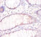 Tubulin Beta 3 Class III antibody, A51998-100, Epigentek, Immunohistochemistry paraffin image 