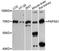 SAT antibody, LS-C748803, Lifespan Biosciences, Western Blot image 
