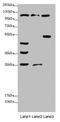 Atrial natriuretic peptide-converting enzyme antibody, LS-C675573, Lifespan Biosciences, Western Blot image 