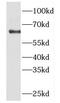 Peptidyl-prolyl cis-trans isomerase FKBP9 antibody, FNab03150, FineTest, Western Blot image 