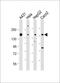 Protein Tyrosine Kinase 7 (Inactive) antibody, A02957-2, Boster Biological Technology, Western Blot image 
