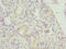 BVR A antibody, LS-C675428, Lifespan Biosciences, Immunohistochemistry paraffin image 
