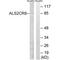 Calcium Responsive Transcription Factor antibody, PA5-49978, Invitrogen Antibodies, Western Blot image 