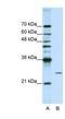 POP4 Homolog, Ribonuclease P/MRP Subunit antibody, NBP1-57218, Novus Biologicals, Western Blot image 