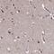 Disco Interacting Protein 2 Homolog B antibody, PA5-61159, Invitrogen Antibodies, Immunohistochemistry frozen image 
