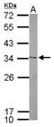 Nucleolar Protein 12 antibody, NBP2-19560, Novus Biologicals, Western Blot image 