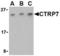 C1q And TNF Related 7 antibody, LS-C484, Lifespan Biosciences, Western Blot image 