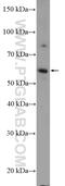 KIAA0895 antibody, 21930-1-AP, Proteintech Group, Western Blot image 