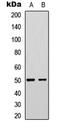 Fibulin 5 antibody, LS-C358752, Lifespan Biosciences, Western Blot image 