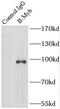 MYB Proto-Oncogene Like 2 antibody, FNab00926, FineTest, Immunoprecipitation image 