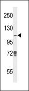 Lysine-specific demethylase 4B antibody, LS-C165362, Lifespan Biosciences, Western Blot image 