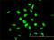 YY1 Transcription Factor antibody, H00007528-M03, Novus Biologicals, Immunofluorescence image 