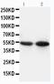 CD14 antibody, PA1443, Boster Biological Technology, Western Blot image 