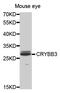 Crystallin Beta B3 antibody, MBS129915, MyBioSource, Western Blot image 