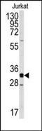 Cyclin Dependent Kinase 2 antibody, AP14142PU-N, Origene, Western Blot image 