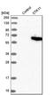 Serine/Threonine Kinase 11 antibody, HPA017254, Atlas Antibodies, Western Blot image 