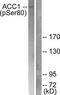 Acetyl-CoA Carboxylase Alpha antibody, TA313412, Origene, Western Blot image 