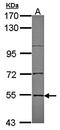 Enhancer Of MRNA Decapping 3 antibody, orb69931, Biorbyt, Western Blot image 