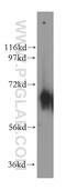Cytosolic purine 5 -nucleotidase antibody, 15223-1-AP, Proteintech Group, Western Blot image 
