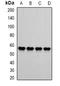 ATP Synthase F1 Subunit Beta antibody, orb340969, Biorbyt, Western Blot image 