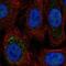 Short transient receptor potential channel 6 antibody, NBP2-55831, Novus Biologicals, Immunofluorescence image 