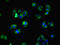 Protein archease antibody, CSB-PA816894LA01HU, Cusabio, Immunofluorescence image 