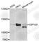 Centrosomal Protein 120 antibody, A8004, ABclonal Technology, Western Blot image 