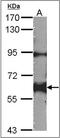 Proto-oncogene tyrosine-protein kinase Yes antibody, AP23146PU-N, Origene, Western Blot image 