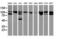 BCAR1 Scaffold Protein, Cas Family Member antibody, LS-C172748, Lifespan Biosciences, Western Blot image 