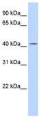 Dehydrodolichyl Diphosphate Synthase Subunit antibody, TA346835, Origene, Western Blot image 