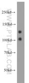 Myosin-XVI antibody, 18828-1-AP, Proteintech Group, Western Blot image 