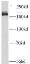 Thrombospondin 1 antibody, FNab08676, FineTest, Western Blot image 