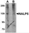 NLR Family Pyrin Domain Containing 5 antibody, 5959, ProSci, Western Blot image 