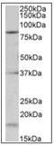 Potassium Voltage-Gated Channel Subfamily C Member 3 antibody, AP31842PU-N, Origene, Western Blot image 