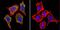 Insulin Like Growth Factor 2 Receptor antibody, GTX22733, GeneTex, Immunofluorescence image 